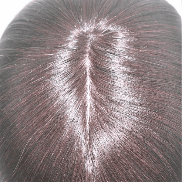 A closeup look at the hair of a person